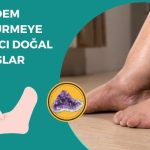 Ödem Söktürmeye Yardımcı Doğal Taşlar