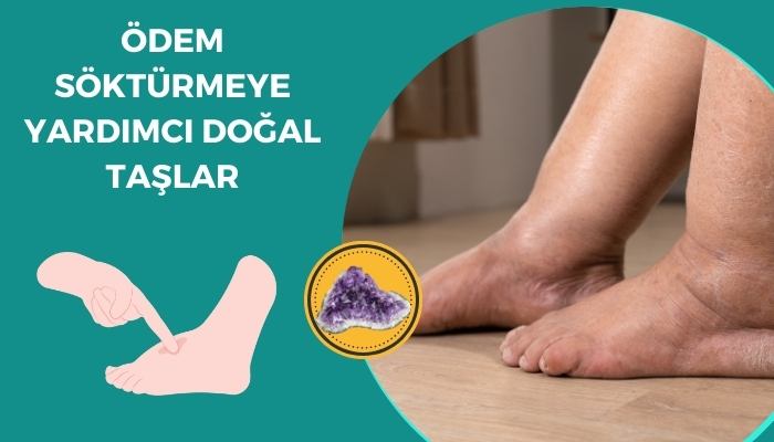 Ödem Söktürmeye Yardımcı Doğal Taşlar